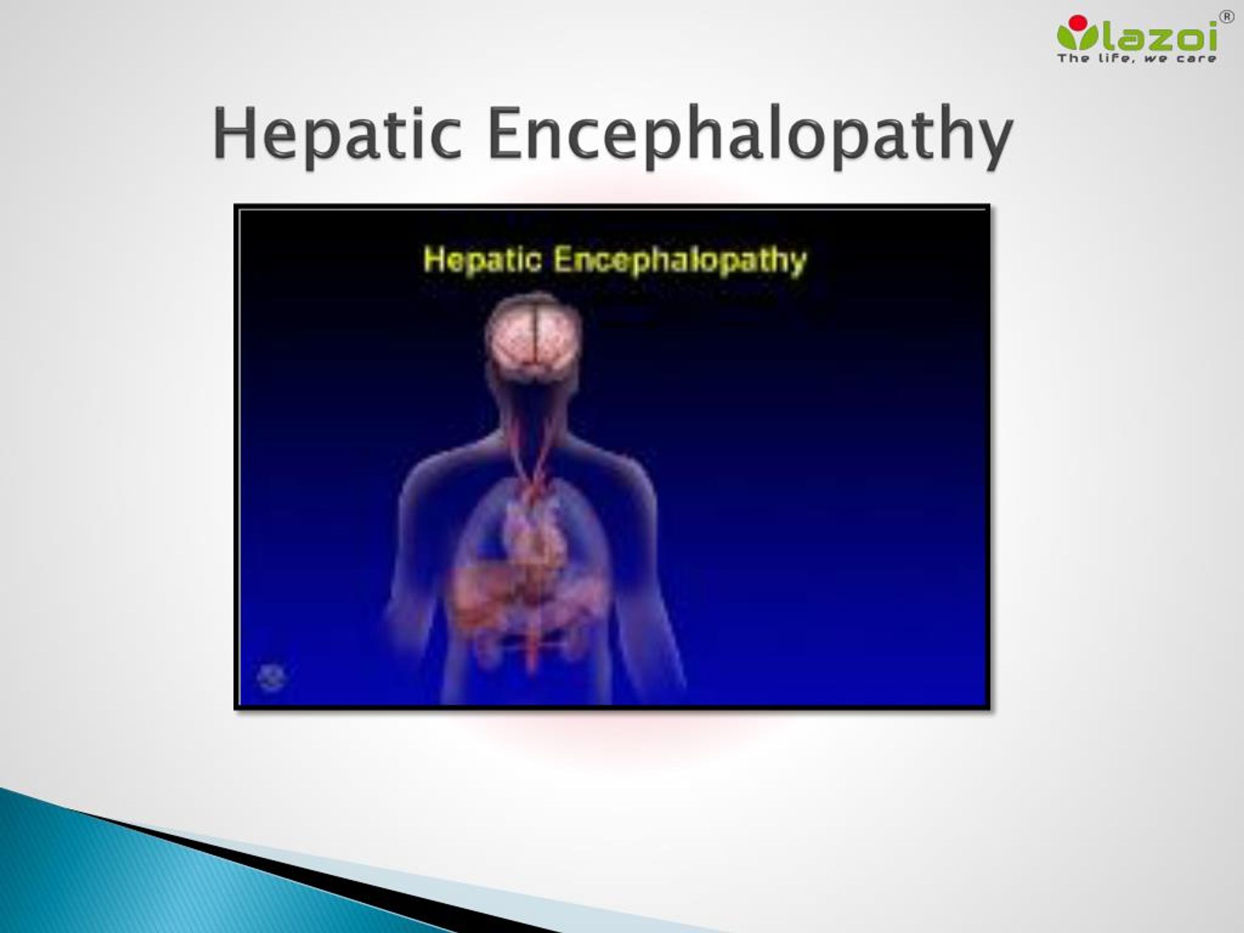 PPT - Hepatic encephalopathy- A brain disease linked to the liver ...