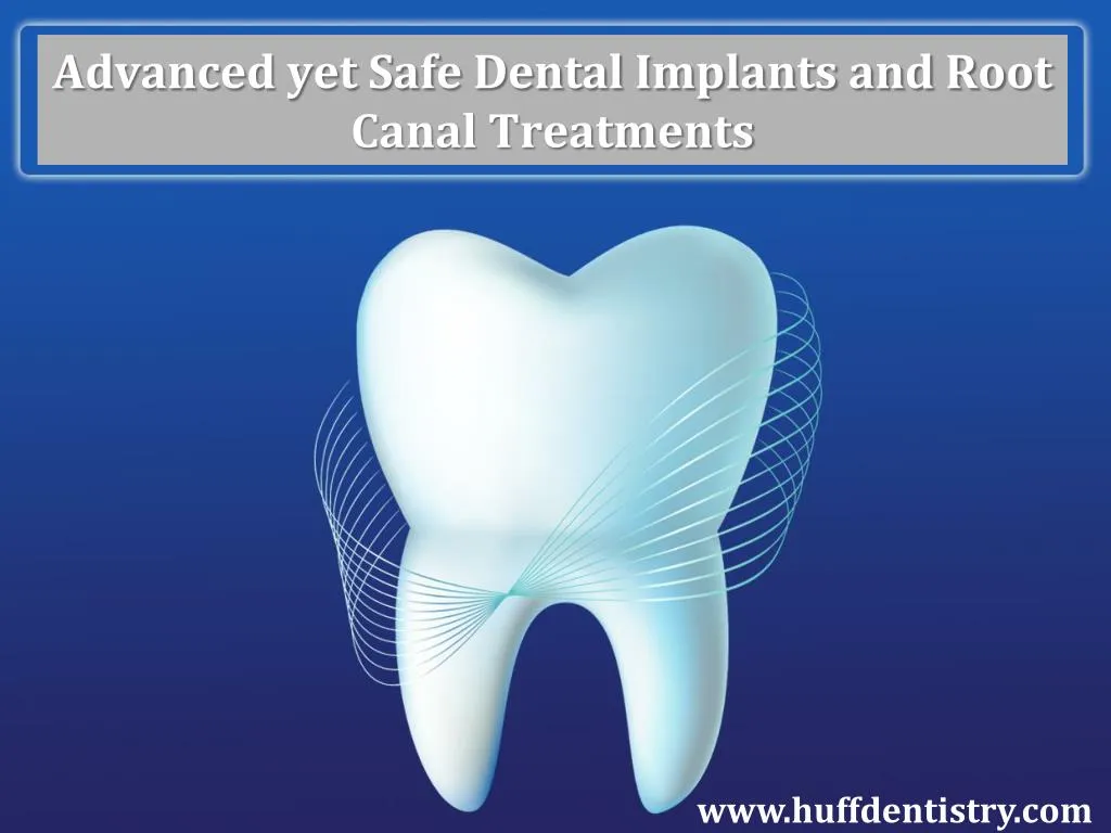advanced yet safe dental implants and root canal treatments n.