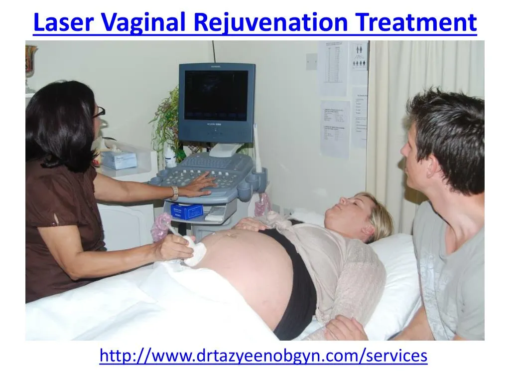 laser vaginal rejuvenation treatment n.