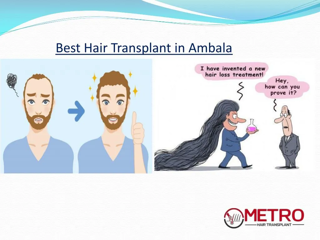 best hair transplant in ambala n.