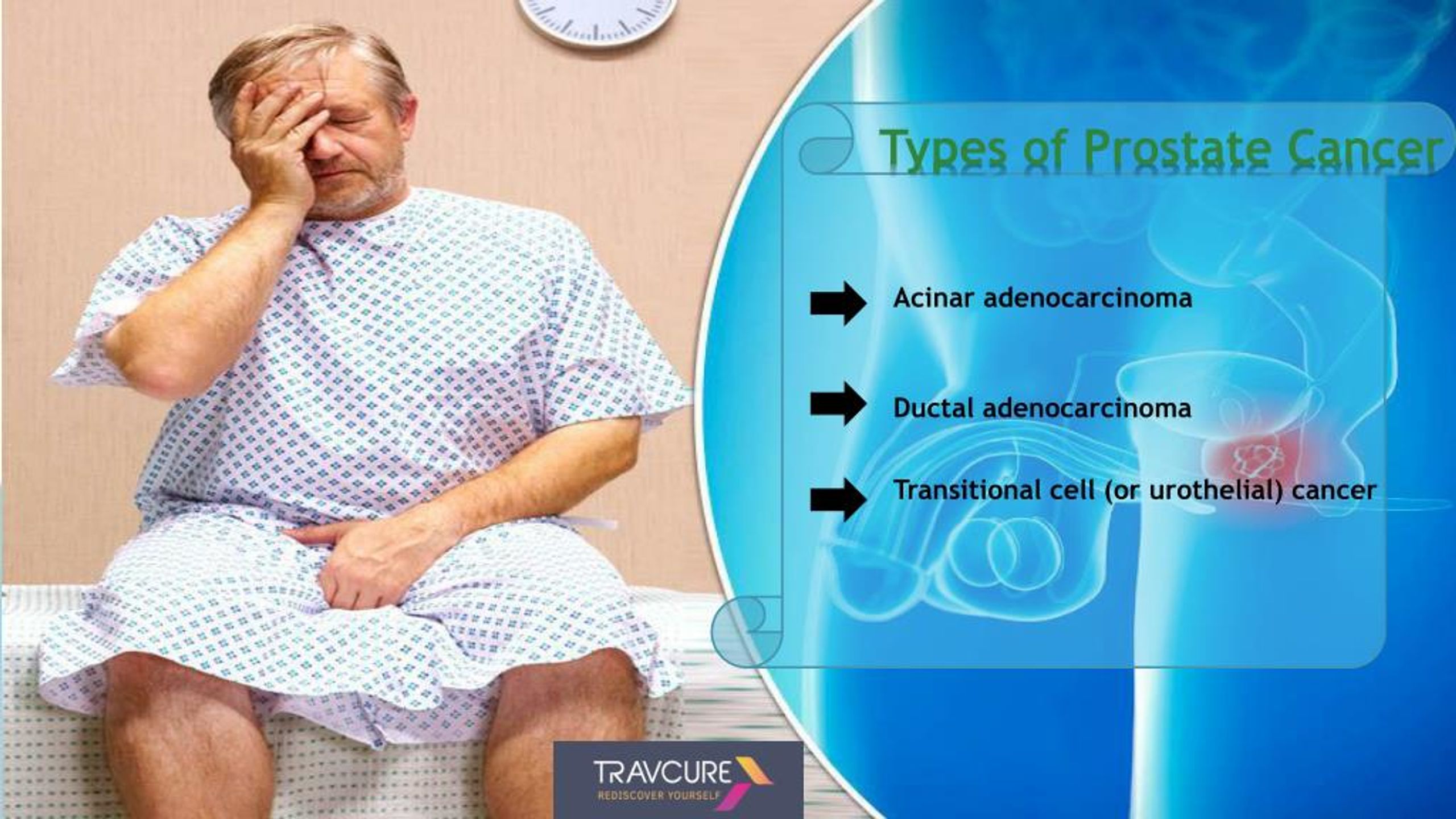 ppt-prostate-cancer-symptoms-types-and-treatment-powerpoint