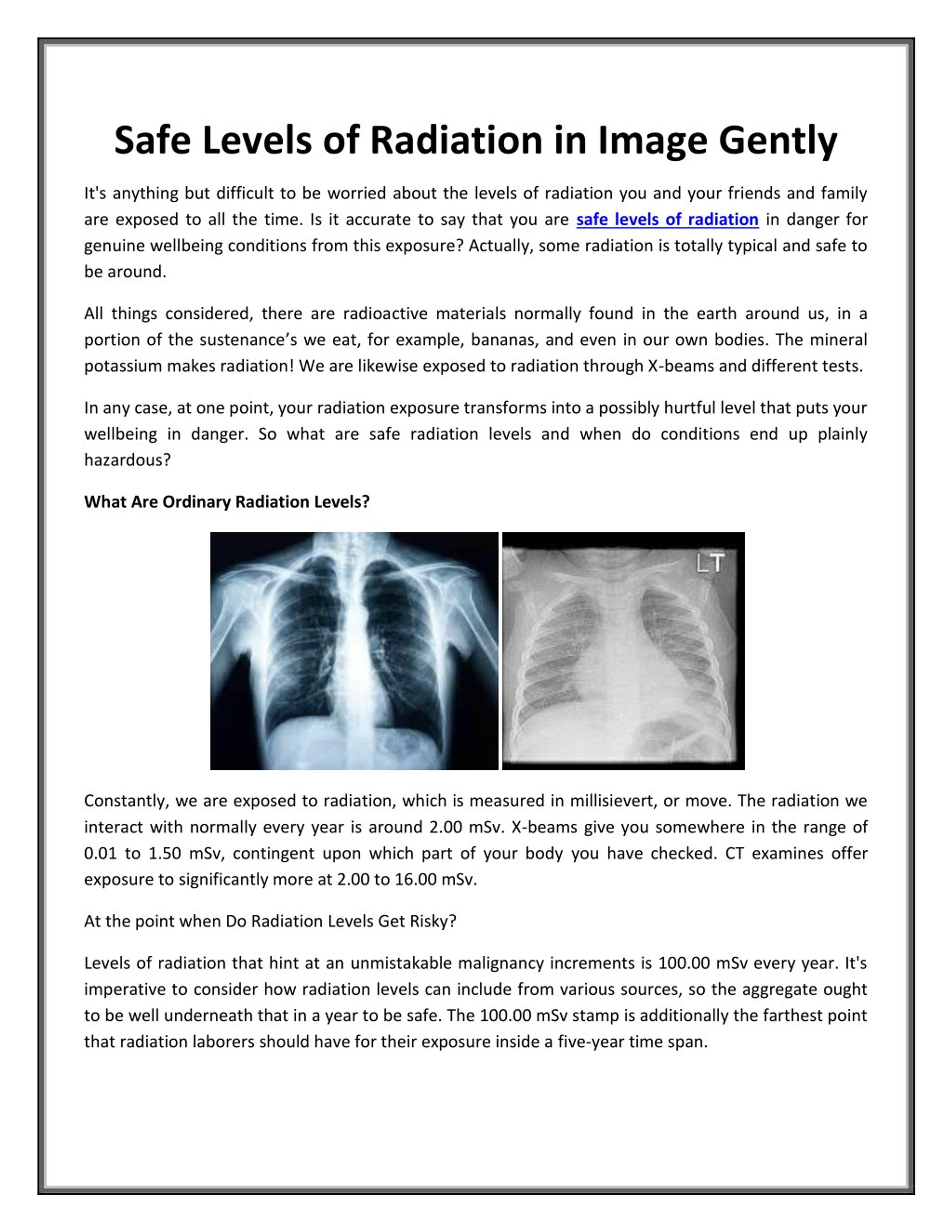 ppt-safe-levels-of-radiation-in-image-gently-powerpoint-presentation