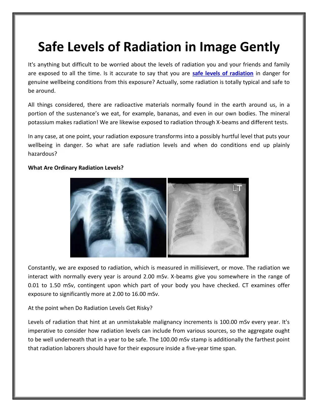 safe levels of radiation in image gently n.