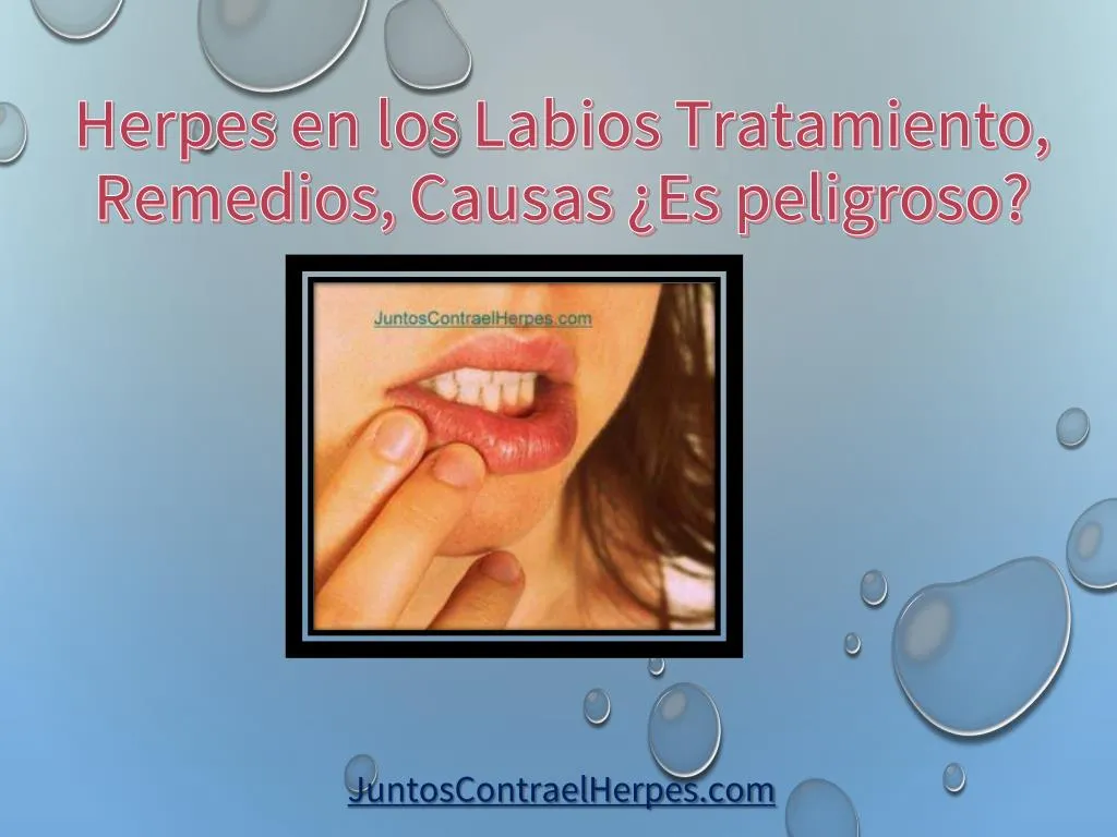 herpes en los labios tratamiento remedios causas es peligroso n.
