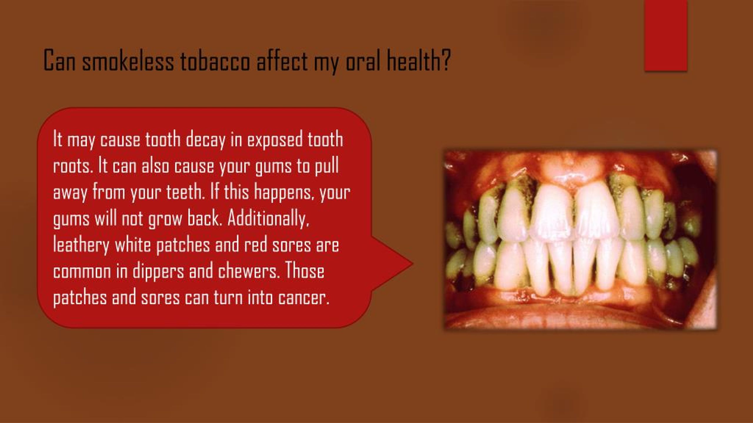 PPT elicit herbal chew, tobacco chew, herbal chew PowerPoint