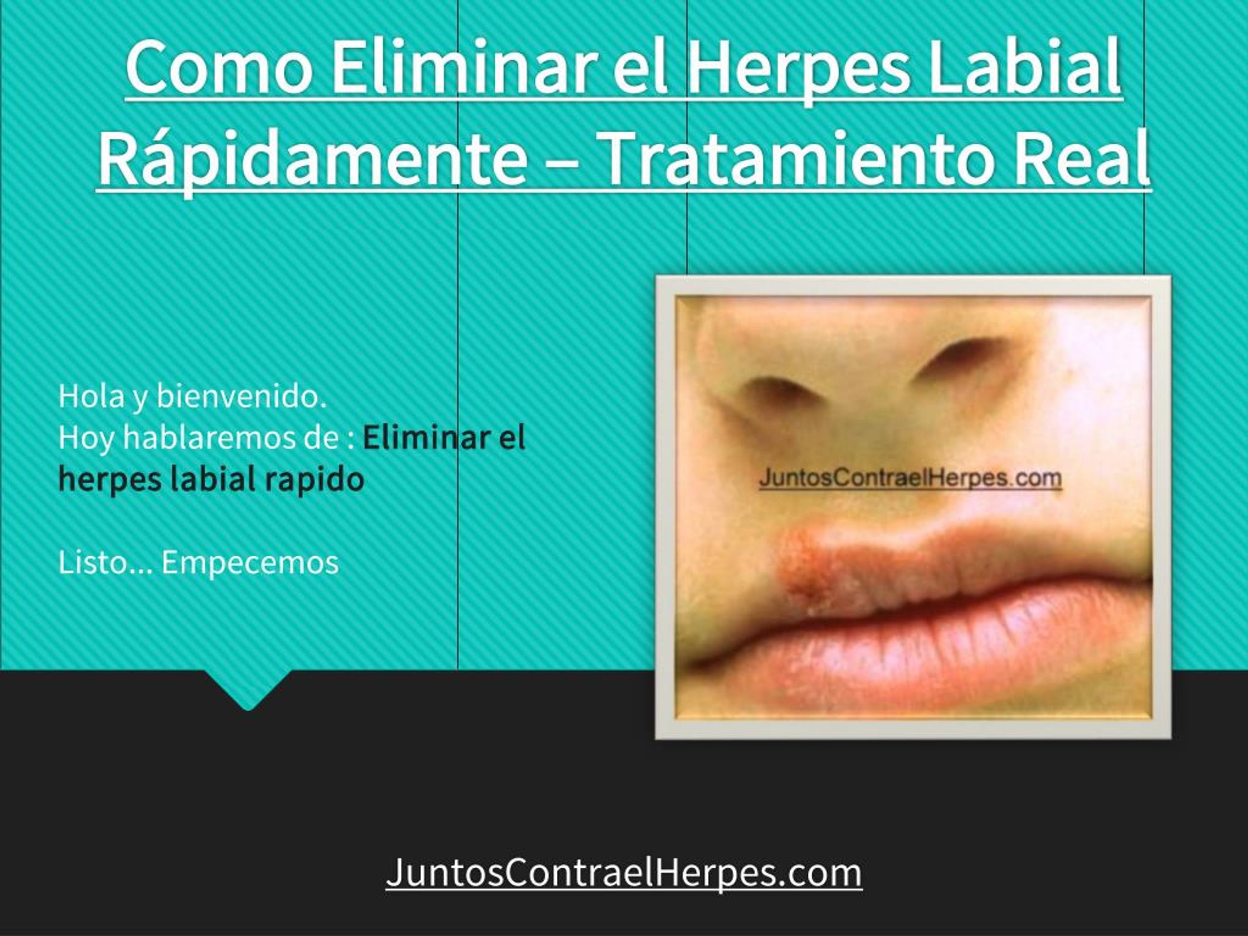 Ppt Como Eliminar El Herpes Labial Rapidamente Tratamiento Real Powerpoint Presentation Id