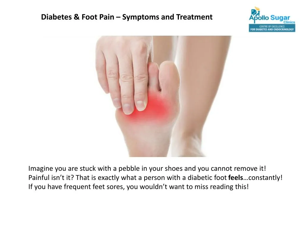 PPT - Diabetes & Foot Pain – Symptoms and Treatment PowerPoint ...