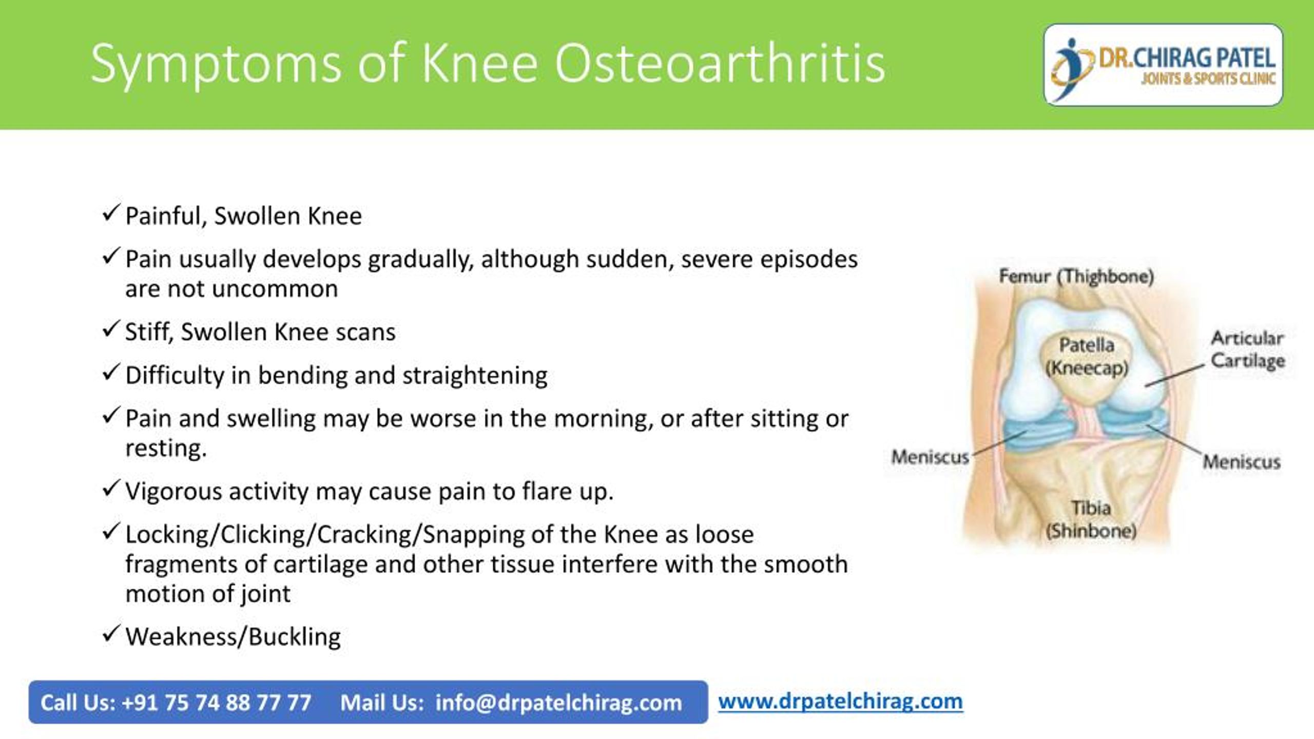 osteoarthritis of knee case presentation ppt