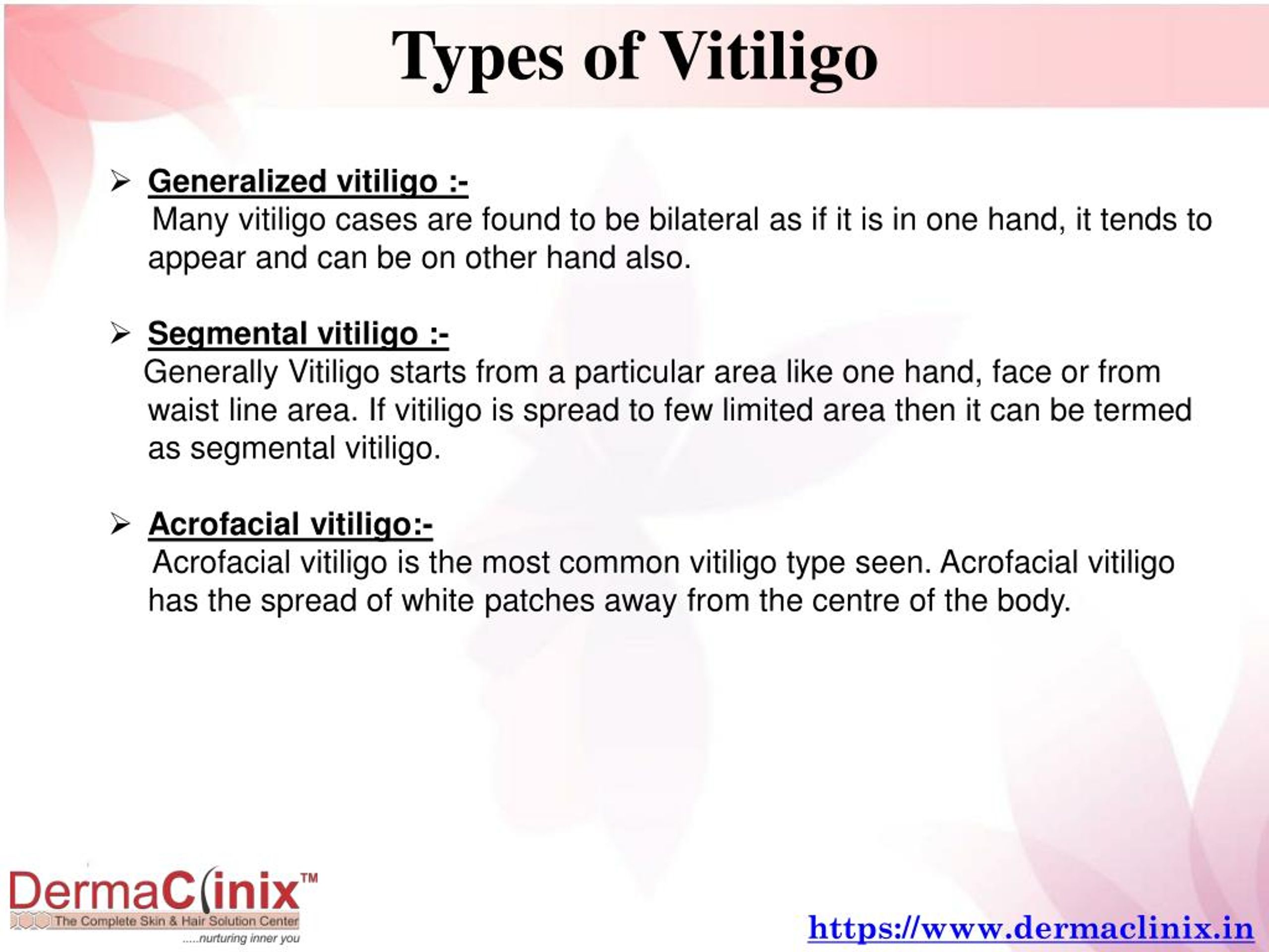 PPT Vitiligo Treatment PowerPoint Presentation free 