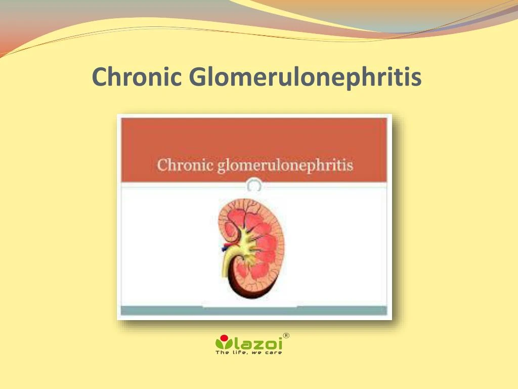 case presentation glomerulonephritis