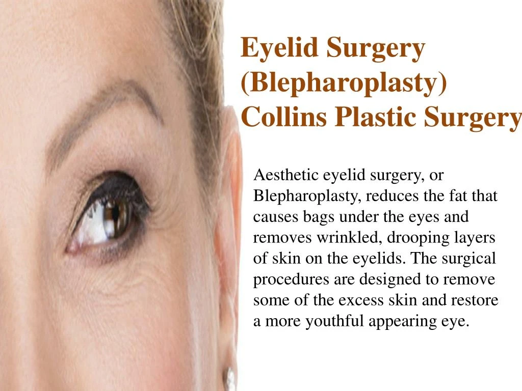 eyelid surgery blepharoplasty collins plastic n.