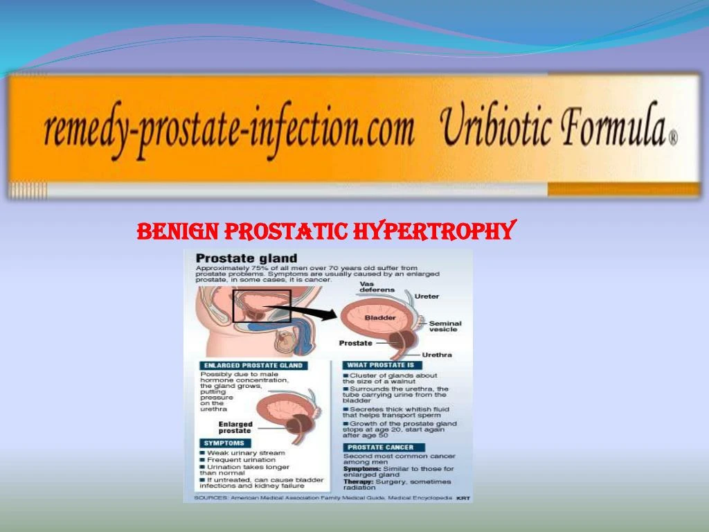 Ppt Benign Prostatic Hypertrophy Powerpoint Presentation Free Download Id7748018 7044