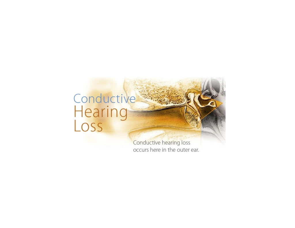 PPT Hard Of Hearing, Hearing Impared, Ruptured Eardrum Hearing Loss