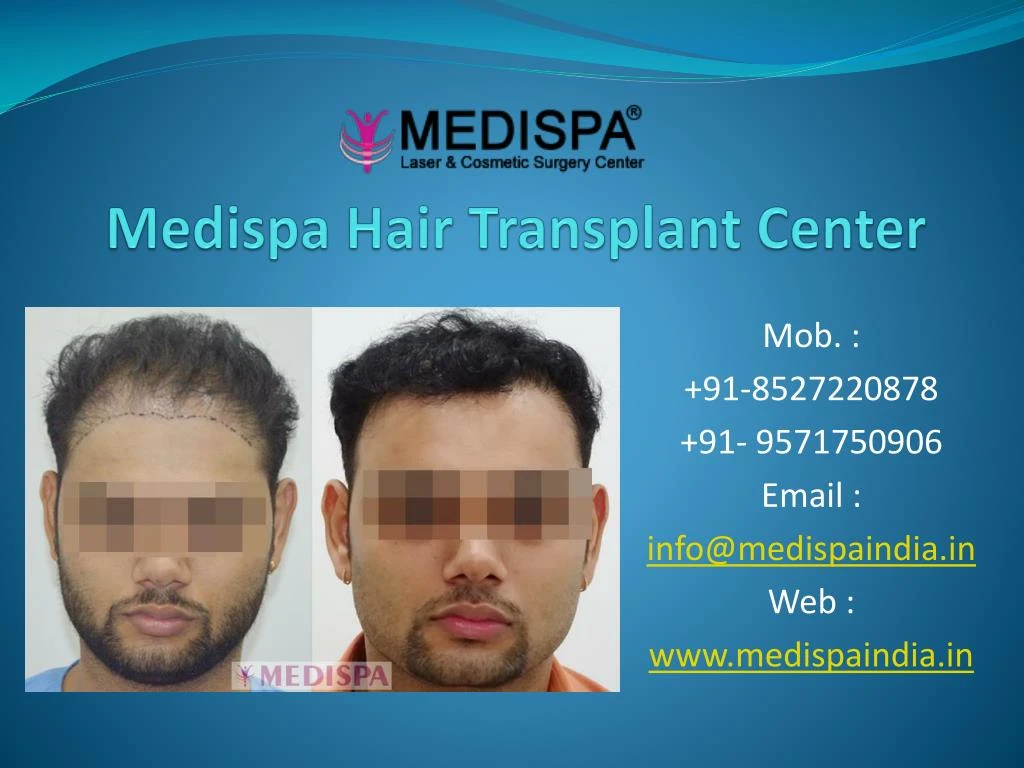 Ppt Best Hair Transplant Clinic In Jaipur Powerpoint