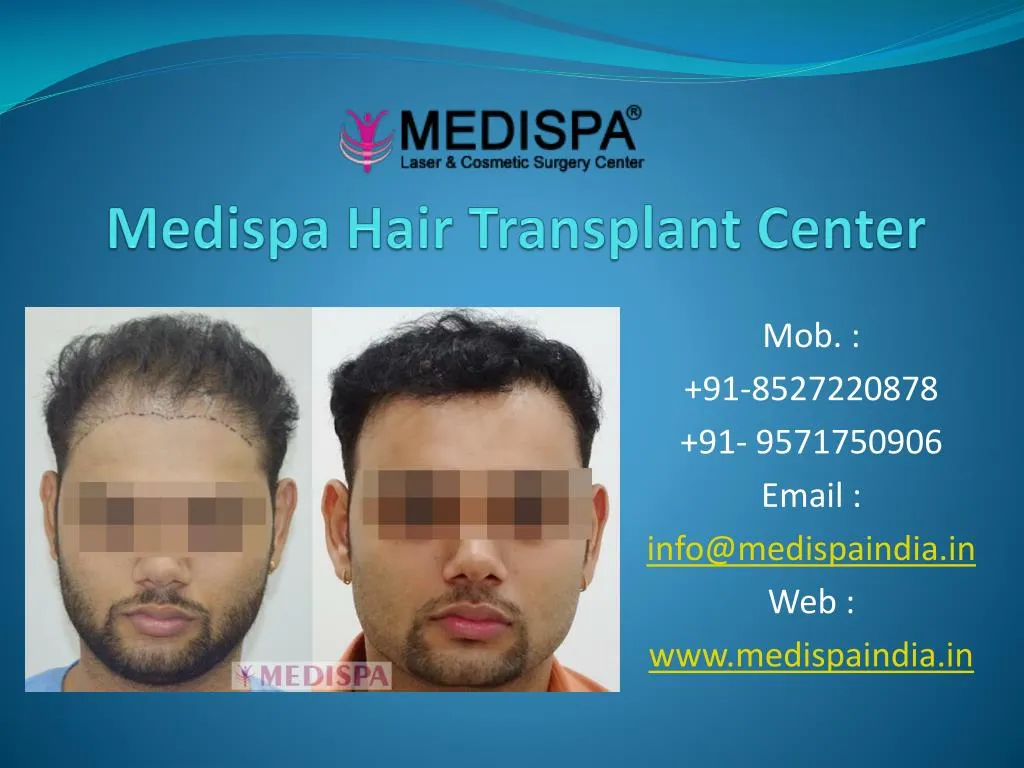 PPT - Best Hair Transplant Clinic In Dubai. PowerPoint Presentation, free  download - ID:7763296