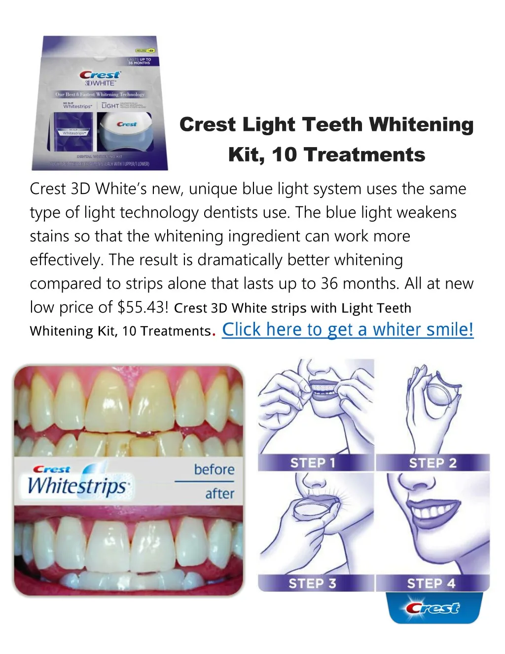 PPT Crest Light Teeth Whitening Kit PowerPoint Presentation, free