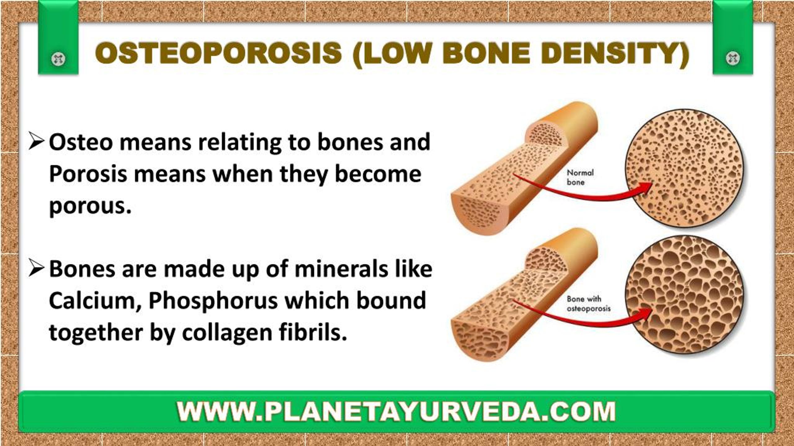 PPT Treatment Of Osteoporosis Low Bone Density In Ayurveda Increase Your Bone Density