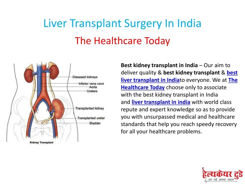 Ppt Liver Transplant Surgery In India Powerpoint Presentation Free Download Id7777512 8405