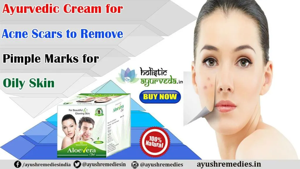 PPT Ayurvedic Cream for Acne Scars to Remove Pimple Marks for Oily