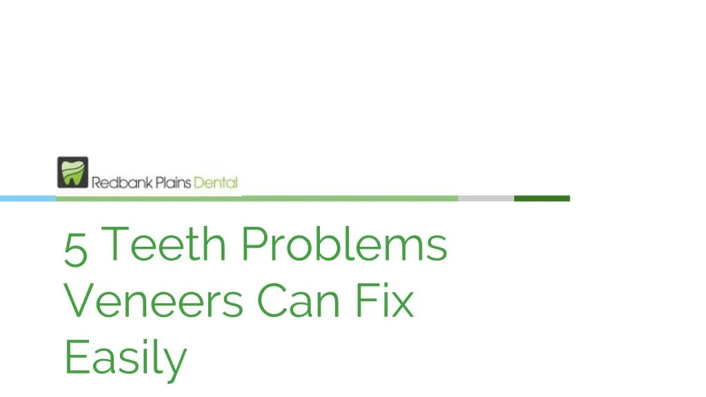 5 teeth problems veneers can fix easily n.
