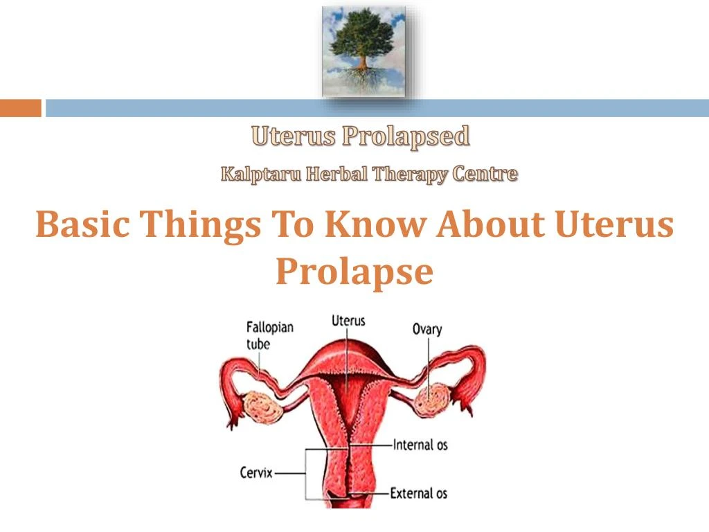 Ppt Uterus Prolapse Powerpoint Presentation Free Download Id7825202 