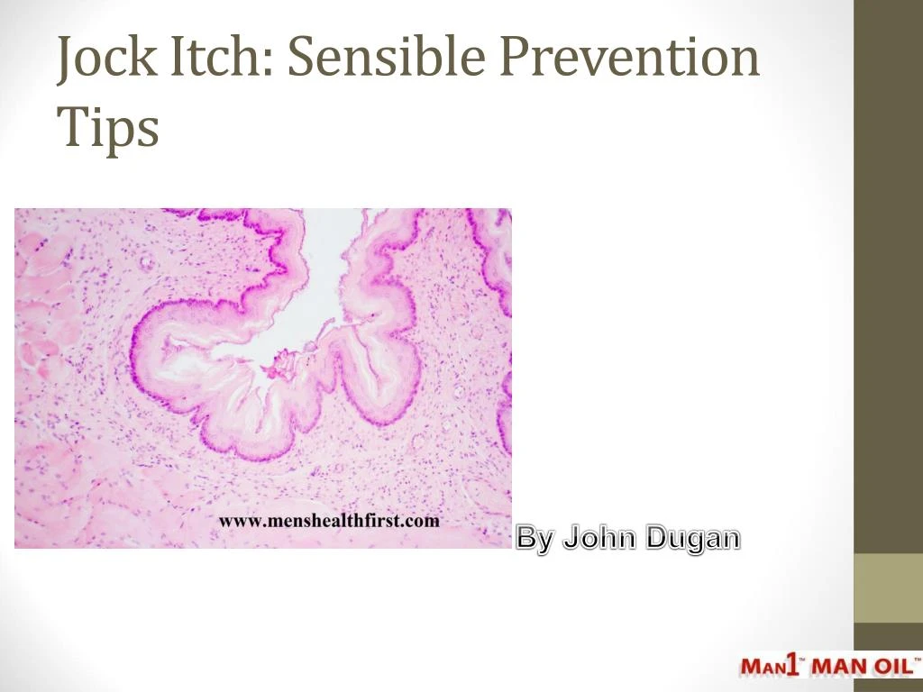 Ppt Jock Itch Sensible Prevention Tips Powerpoint Presentation Free Download Id7845691 