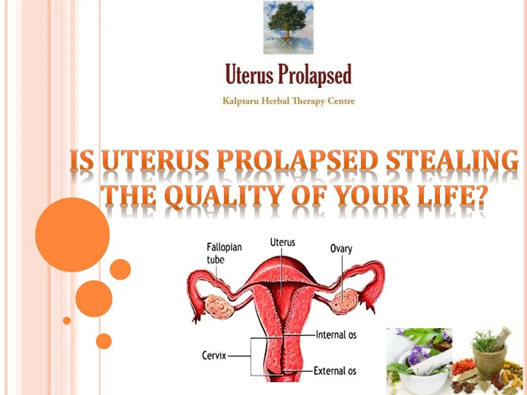 Ppt Is Uterus Prolapsed Stealing The Quality Of Your Life Powerpoint