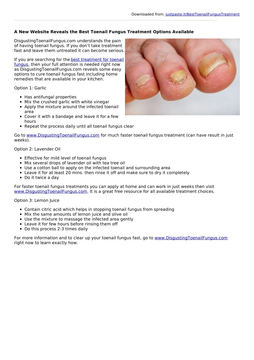 PPT A New site Reveals the Best Toenail Fungus Treatment Options