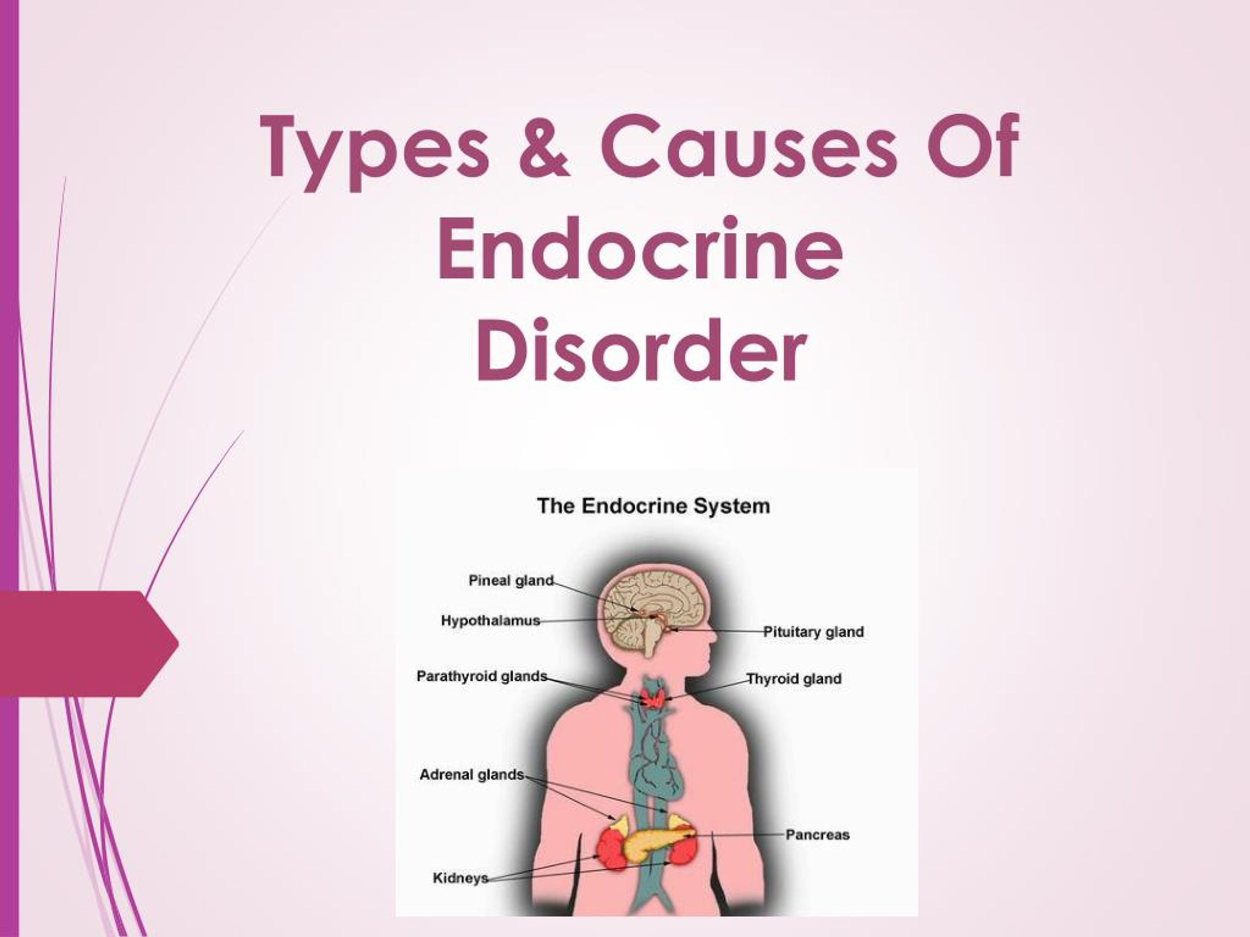 Ppt Types And Causes Of Endocrine Disorder Powerpoint Presentation