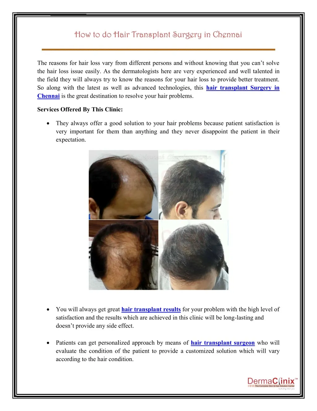PPT - How to do Hair Transplant Surgery in Chennai PowerPoint Presentation  - ID:7904717