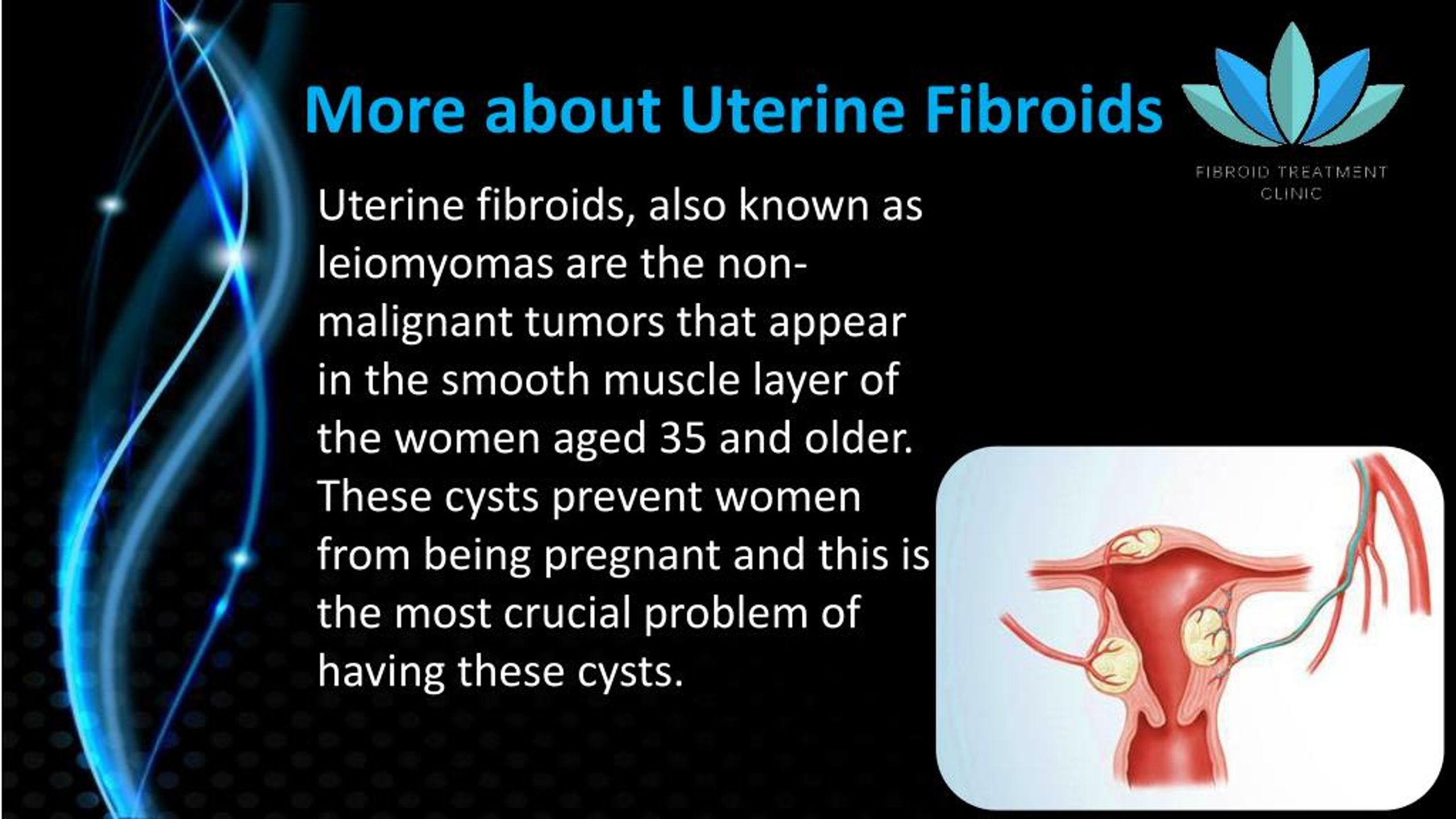 PPT - Contact Fibroid Treatment Clinic to Have a Pain Free Life ...