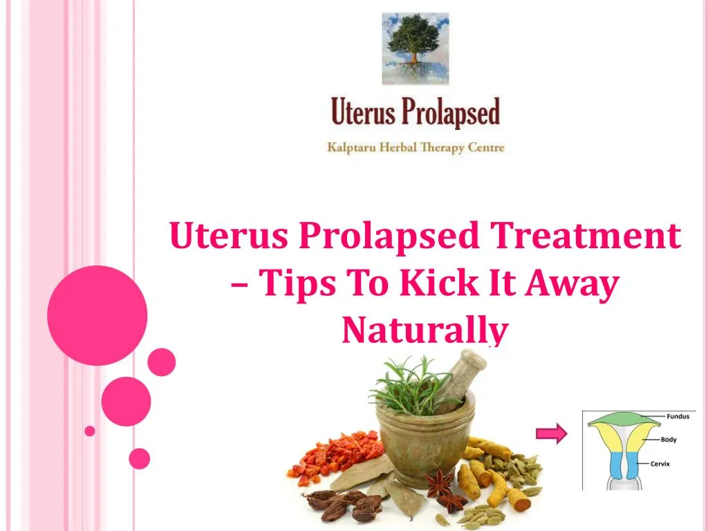 Ppt Uterus Prolapsed Treatment â€“ Tips To Kick It Away Naturally