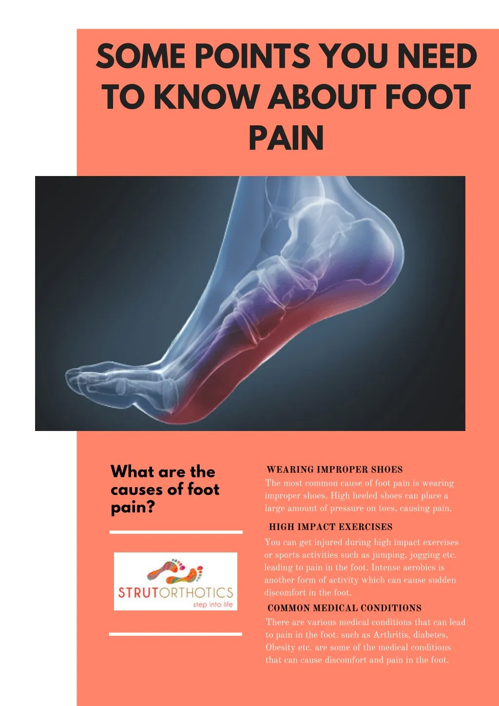 PPT - Some Points You Need to Know about Foot Pain PowerPoint ...