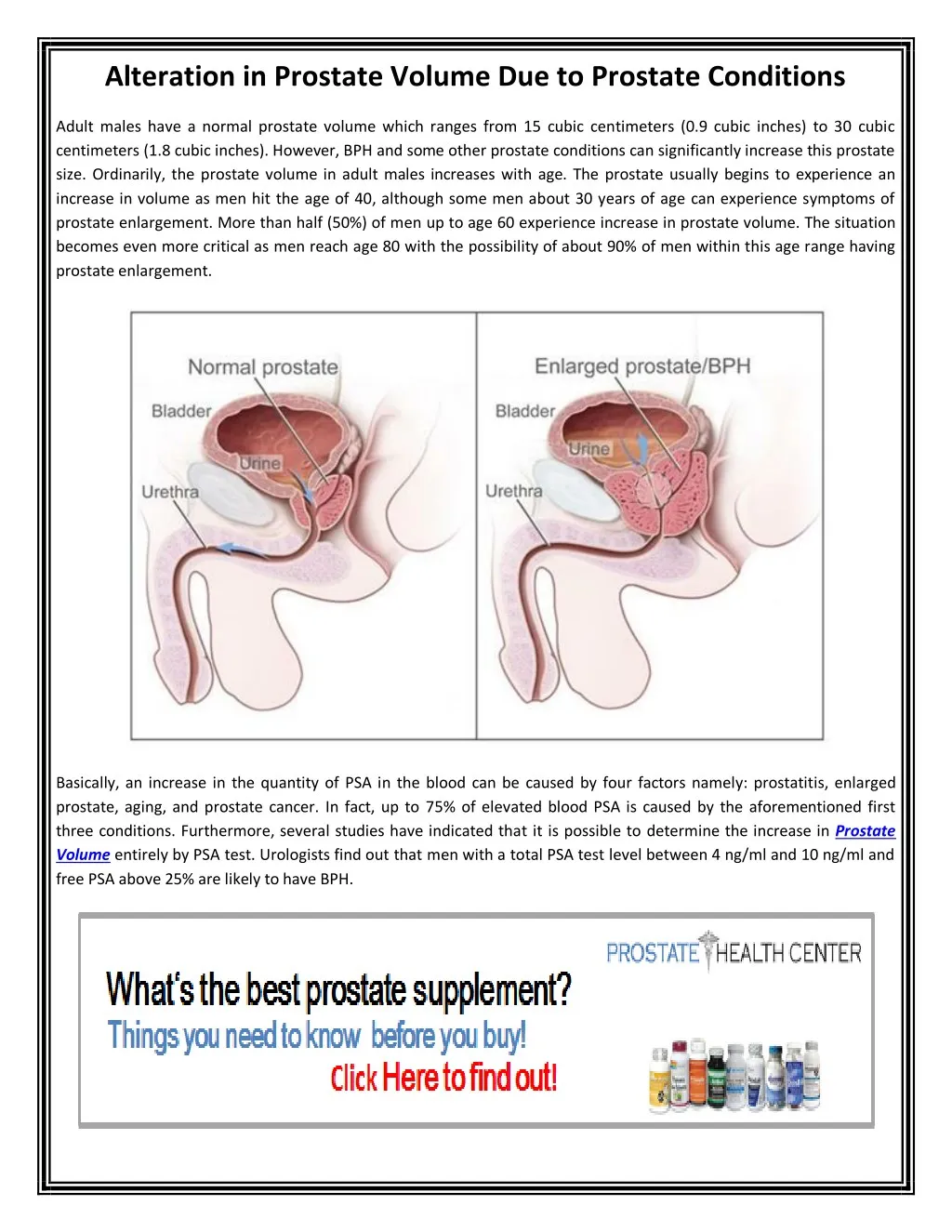 Normal Prostate Volume Chart PPT - Prostate Volume PowerPoint Presentation, free download - ID:7926147