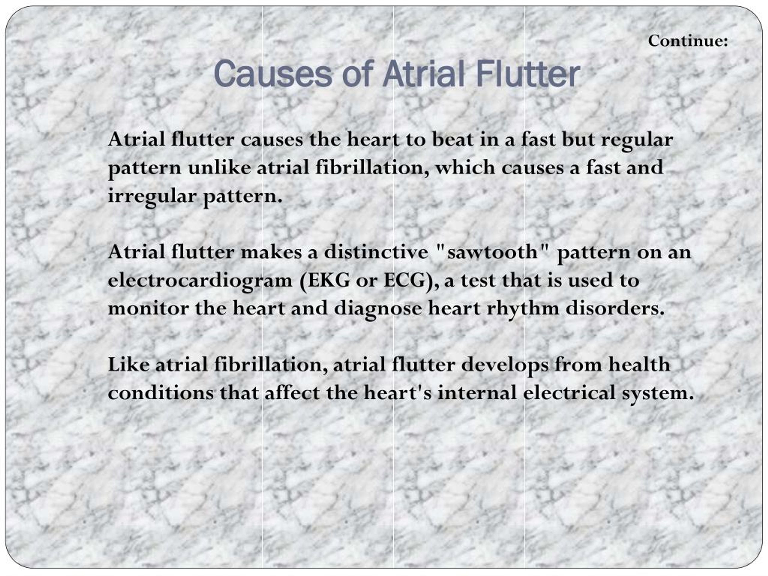 Ppt Atrial Flutter Powerpoint Presentation Free Download Id 7927247