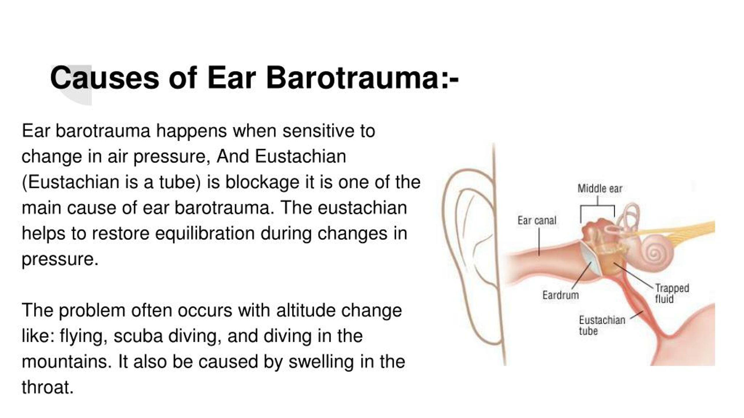 Ppt Ear Barotrauma Pressure In The Ears Causes Symptoms