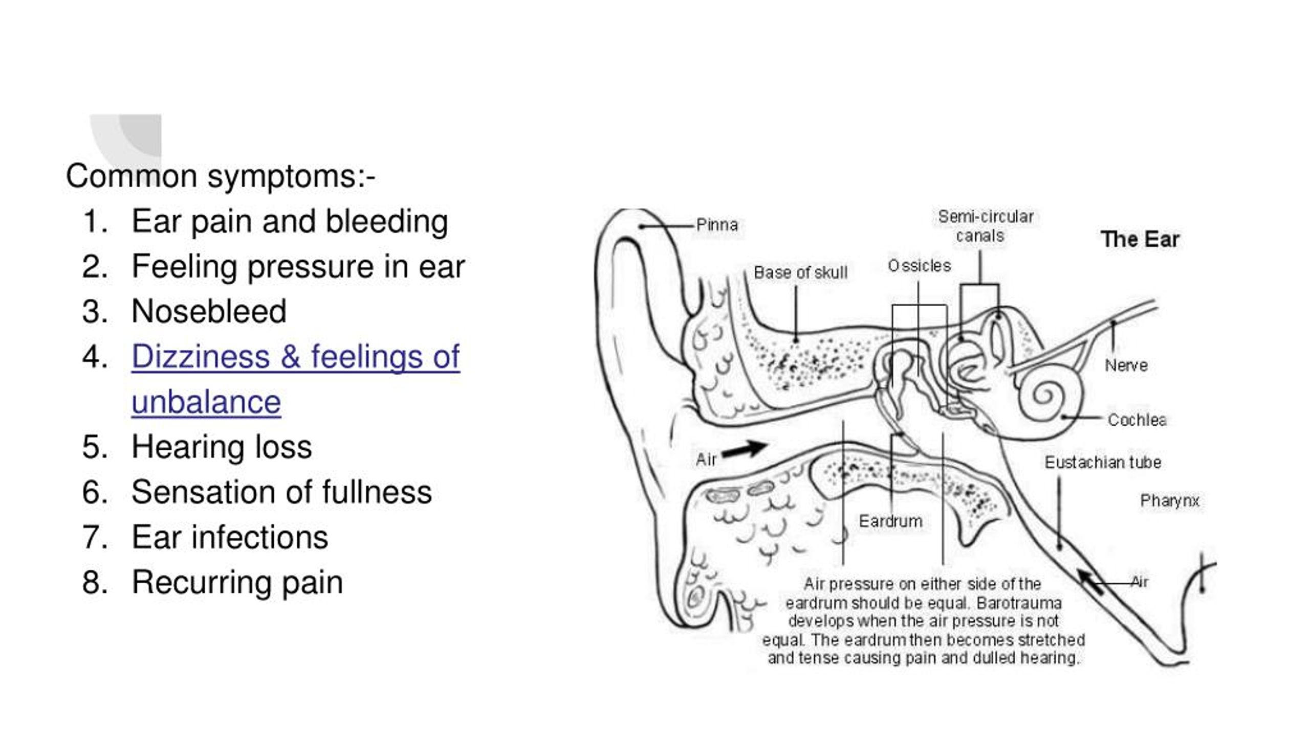 inner ear barotrauma recovery time