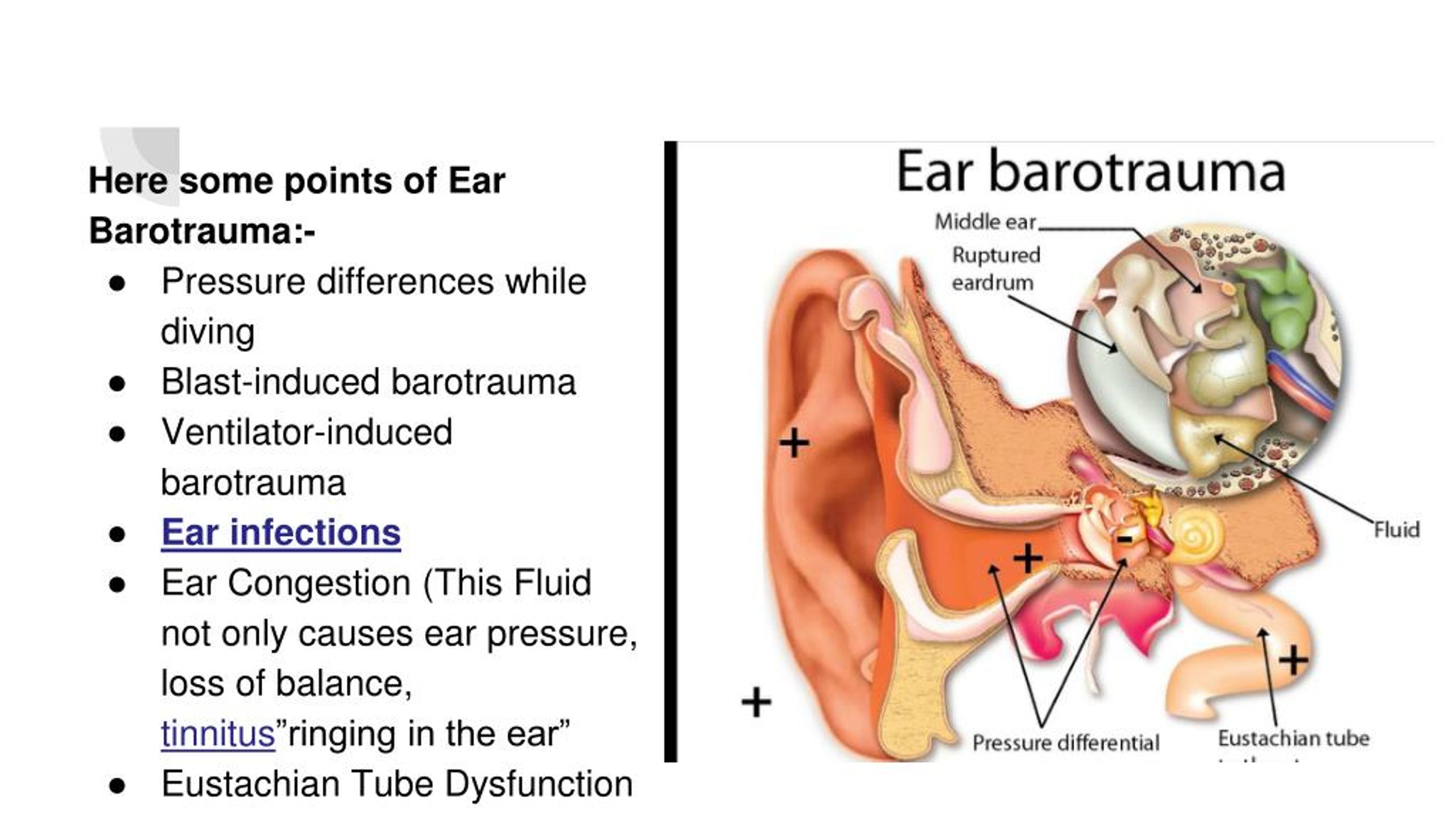 inner ear barotrauma treatment
