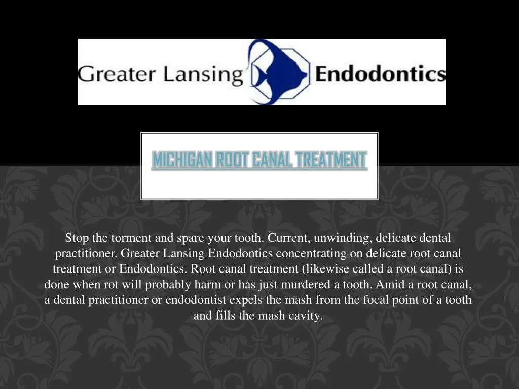 michigan root canal treatment n.