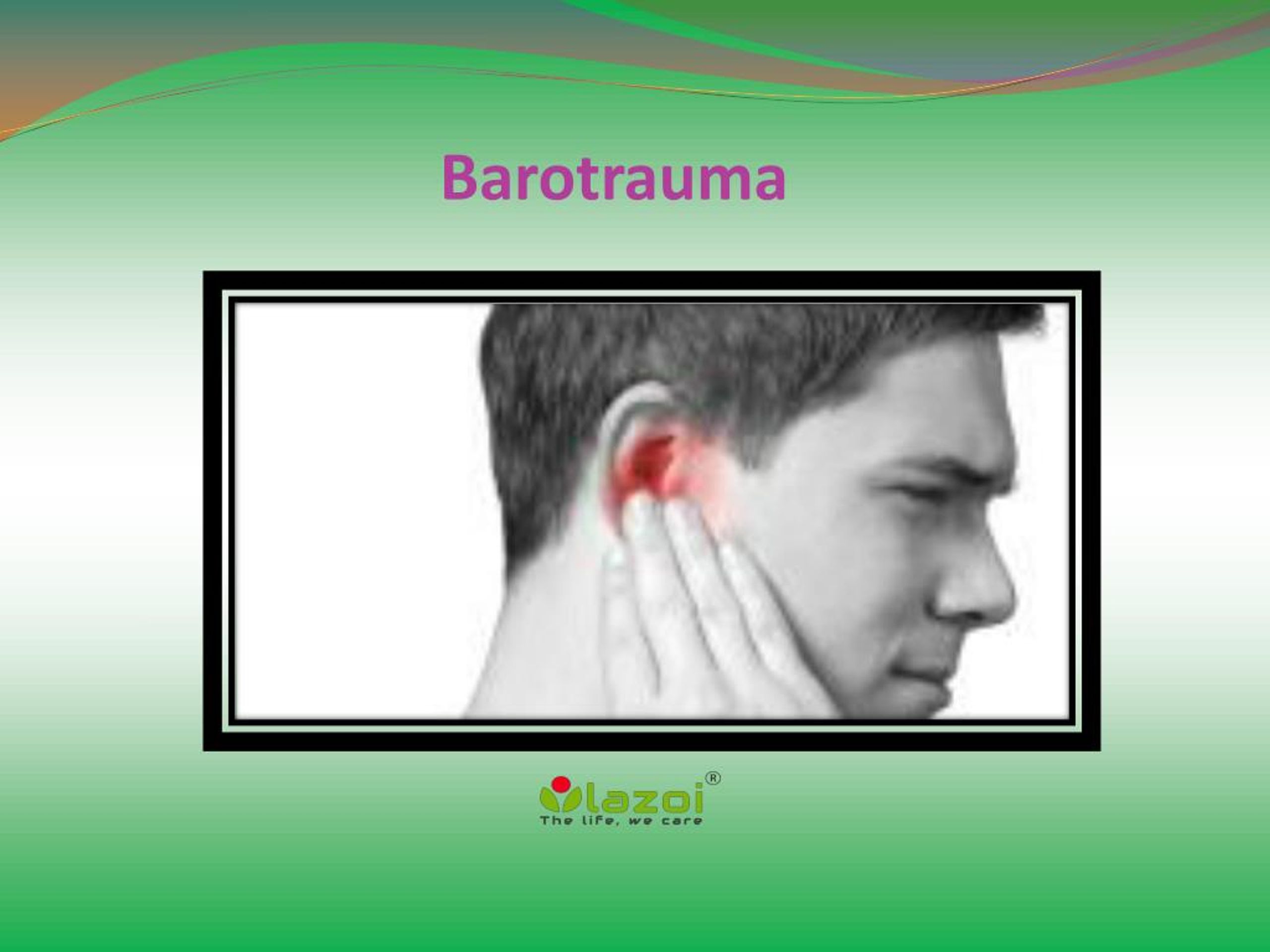 barotrauma definition