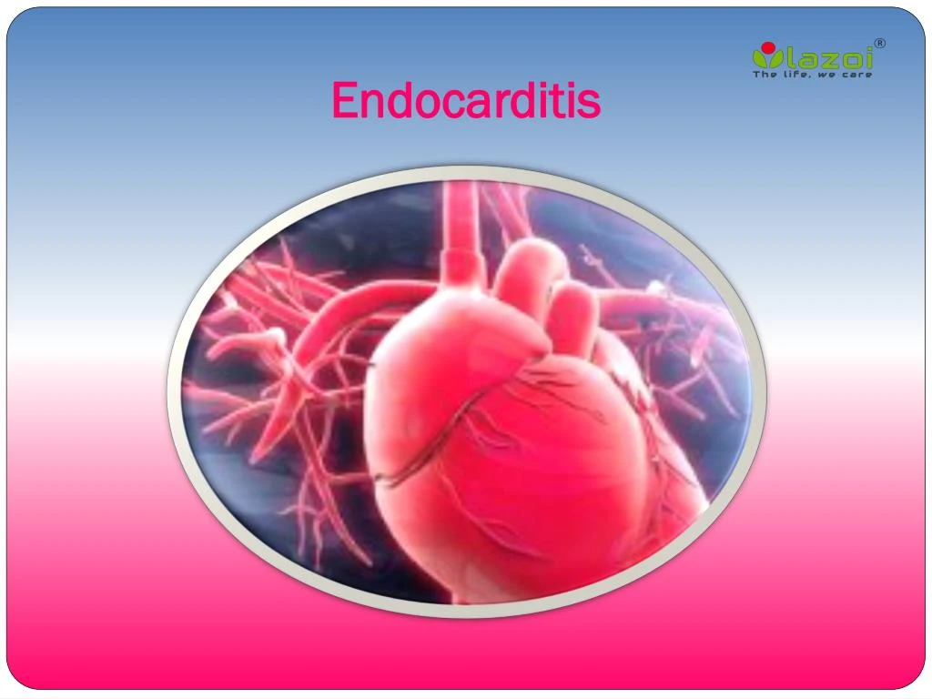endocarditis n.