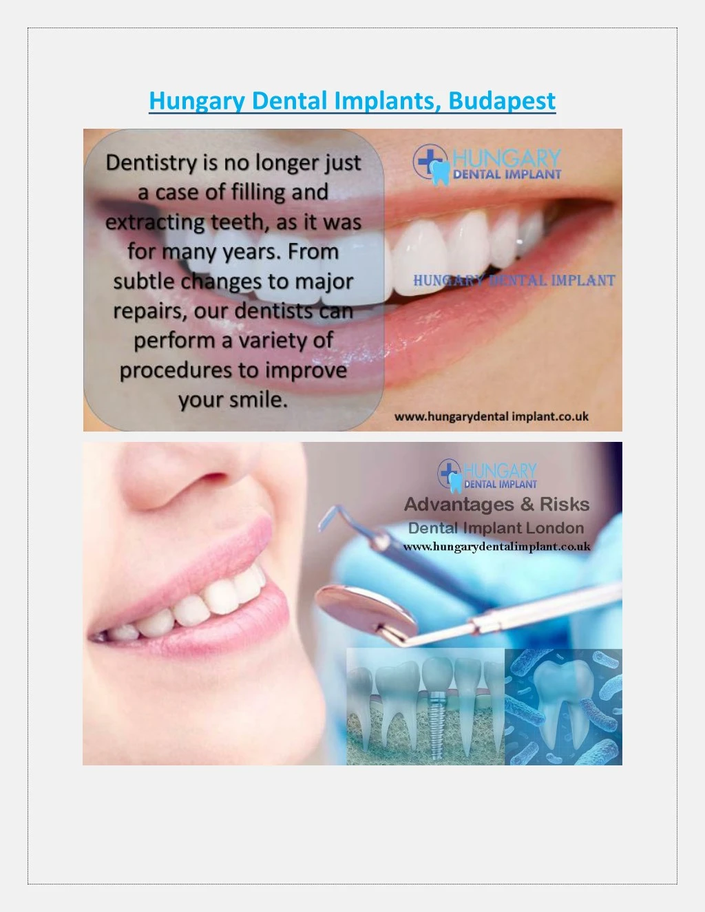 PPT Hungary Dental Implants, Budapest PowerPoint Presentation, free