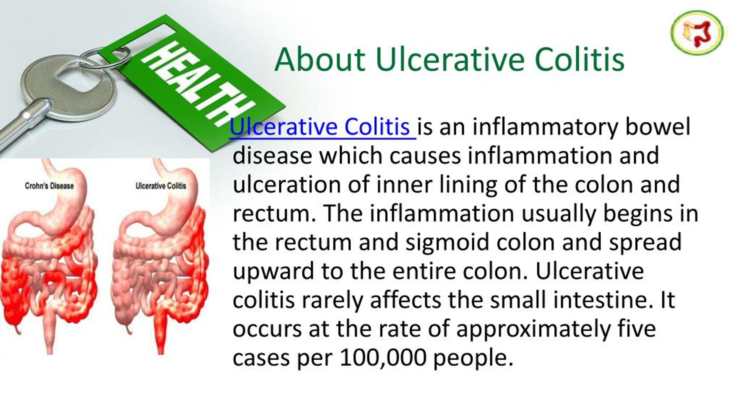 PPT Take Ayurveda Based Ulcerative Colitis Treatment by