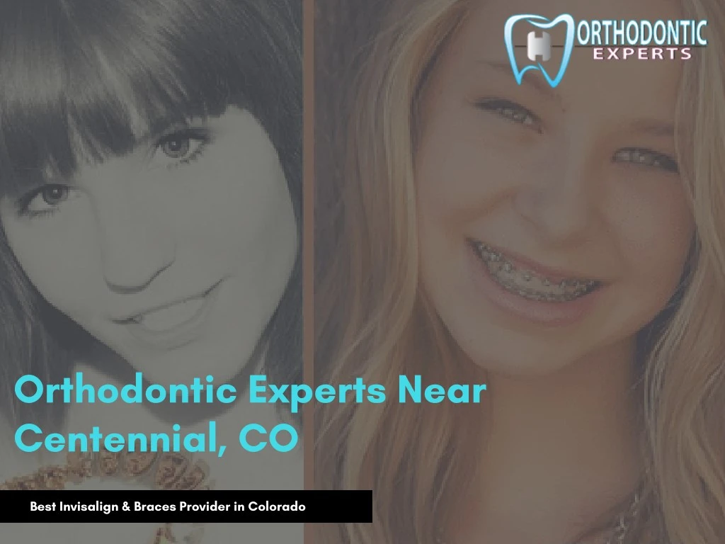 orthodontic experts near centennial co n.