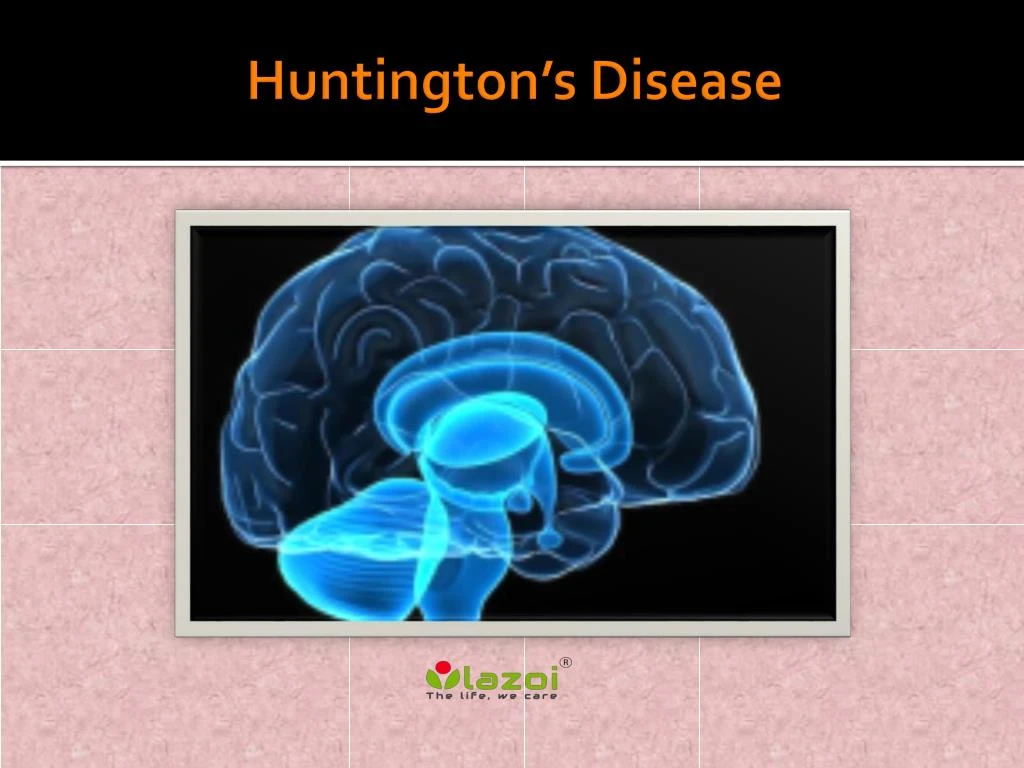 PPT - Huntingtonâ€™s Disease: Causes, Symptoms, Daignosis, Prevention ...