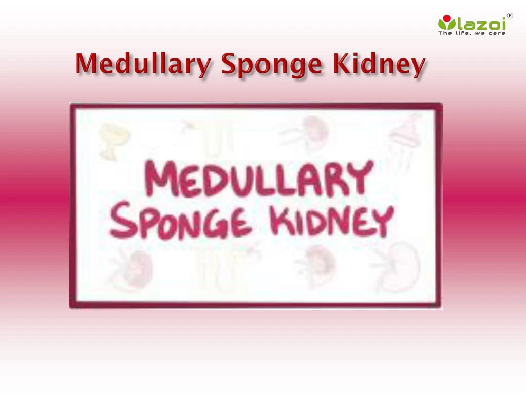 PPT - Medullary Sponge Kidney: Causes, Symptoms, Daignosis, Prevention ...