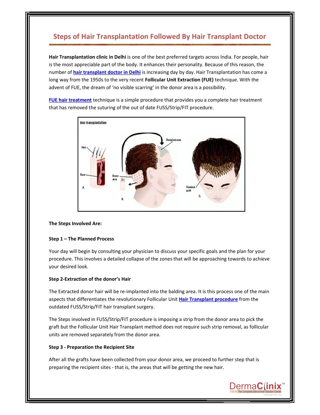 PPT - Steps Of Hair Transplantation Followed By Hair Transplant Doctor  PowerPoint Presentation - ID:7982607