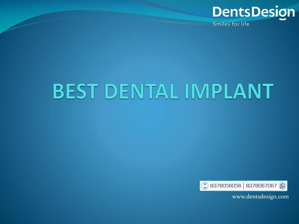 PPT - Best Dental Implant PowerPoint Presentation, Free Download - ID ...