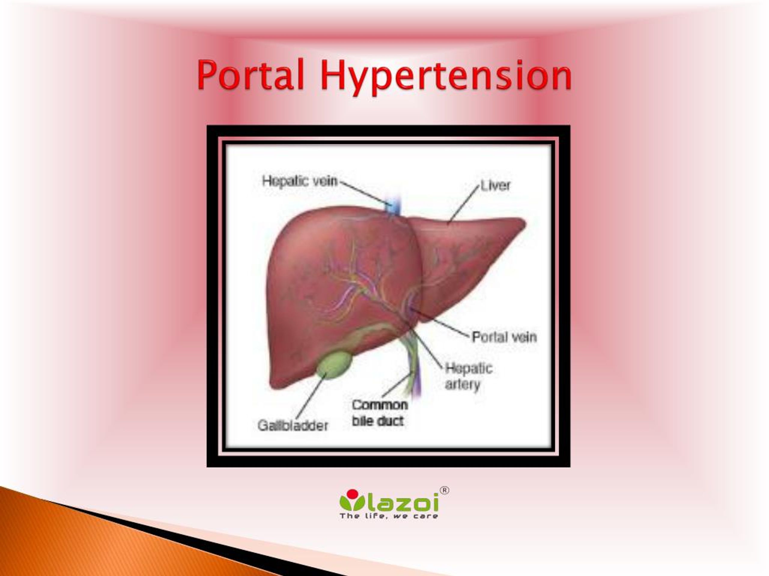 clinical presentation of portal hypertension