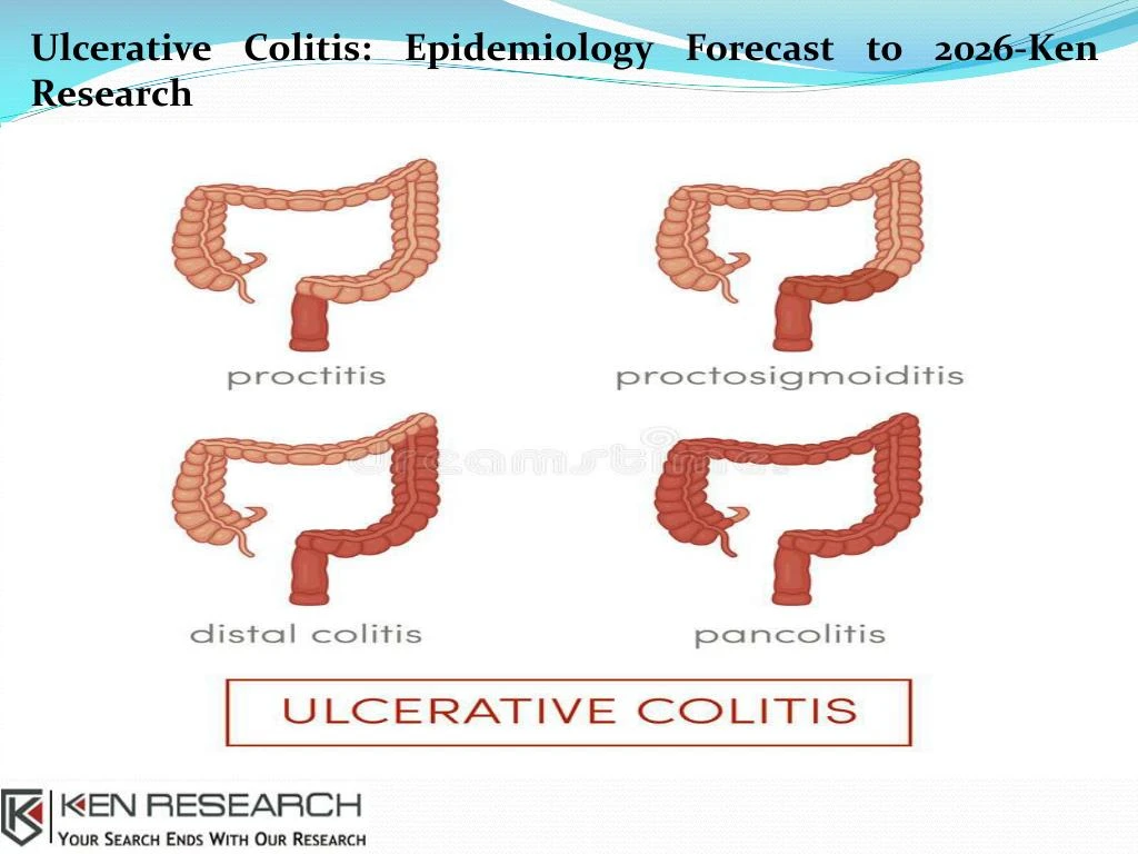 ulcerative colitis epidemiology forecast to 2026 n.